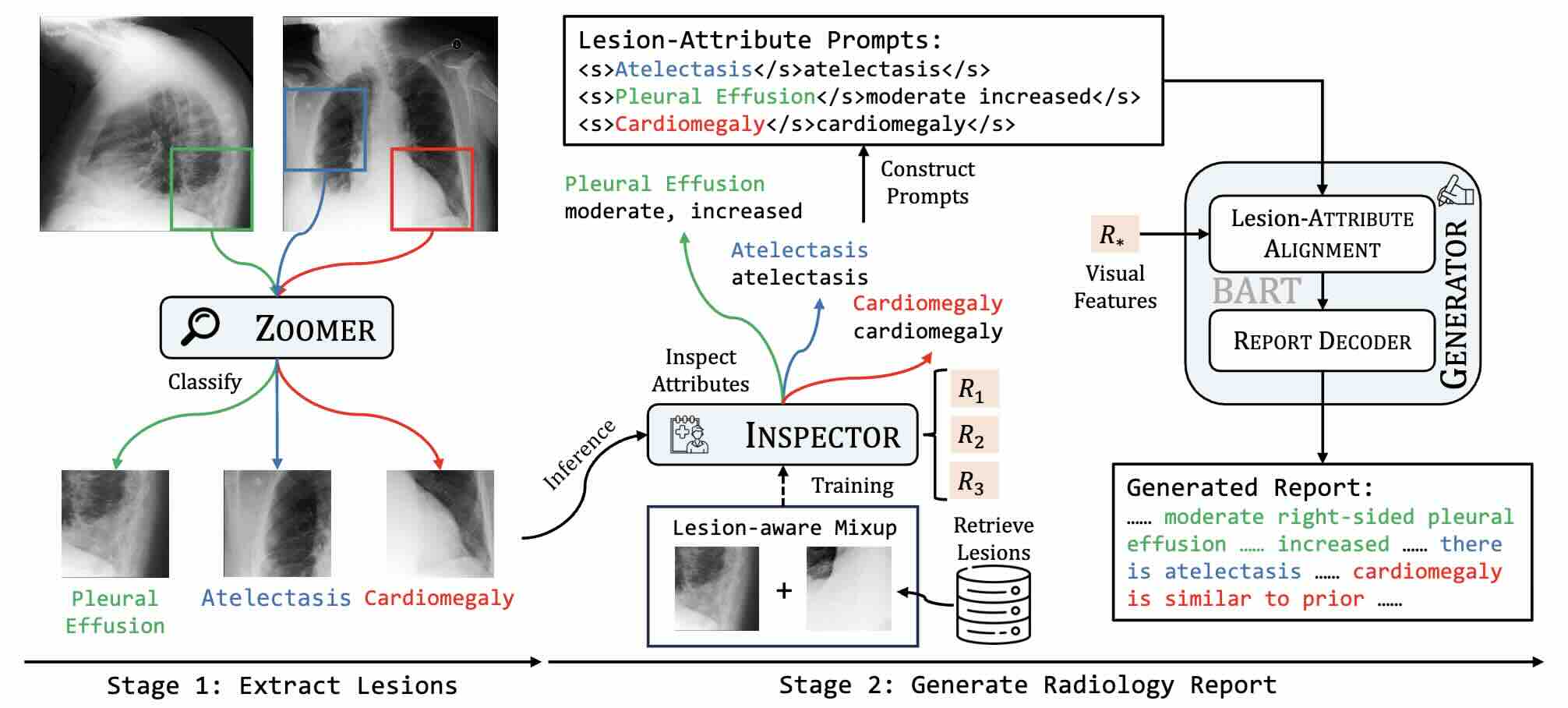 ICON: Improving Inter-Report Consistency in Radiology Report Generation via Lesion-aware Mixup Augmentation