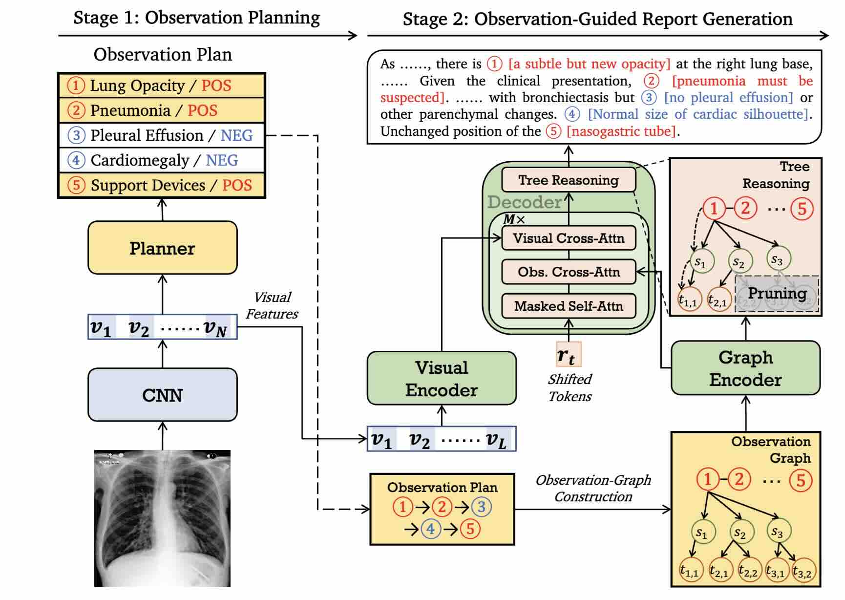 ORGAN: Observation-Guided Radiology Report Generation via Tree Reasoning
